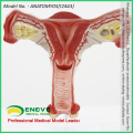 SELL 12443 Model Uterus Show Female Genital Structures Uterine Anatomy Model